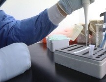 las pruebas PCR que se envían a análisis a laboratorio son las recomendables para detectar la viruela del mono. EL INFORMADOR/ ARCHIVO