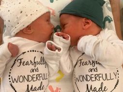 Lydia Ann y Timothy Ronald Ridgeway nacieron el 31 de octubre de 2022. EPA