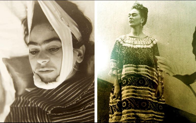 La causa de la muerte de Frida Kahlo fue oficialmente una 